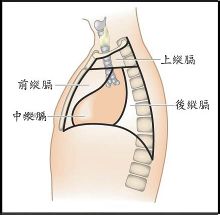 Mediastinalis