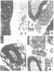 Perifériás neuropathia